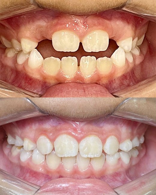 LUCIANAFOTOS-CASOS-02