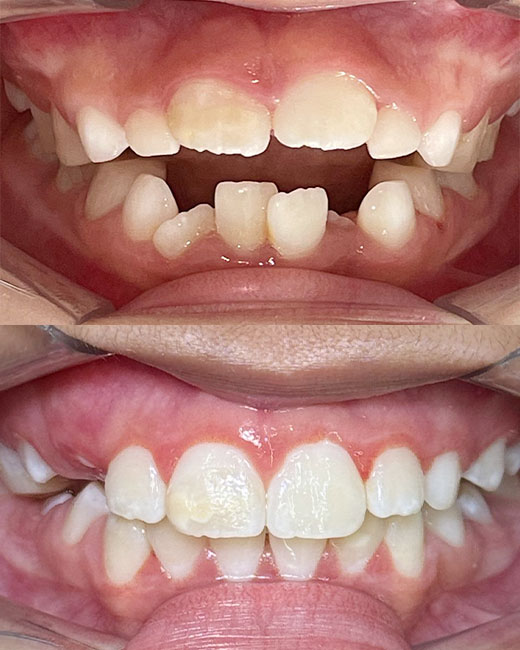 LUCIANAFOTOS-CASOS-03